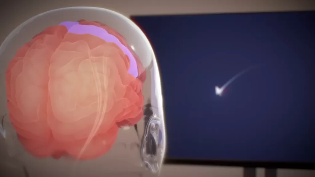 Neuralink Videosu, Zihniyle Video Oyunları Oynayabilen Felçli Hastayı Gösteriyor!
