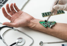 AI yara iyileştirme cihazı ile iyileşme süresi azalıyor