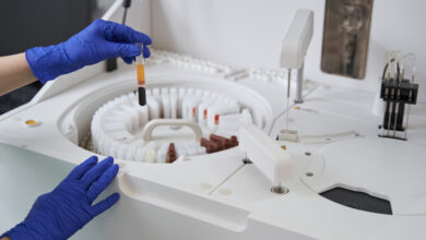 Felç tedavisinde kök hücre tedavisi umut verici sonuçlar sundu